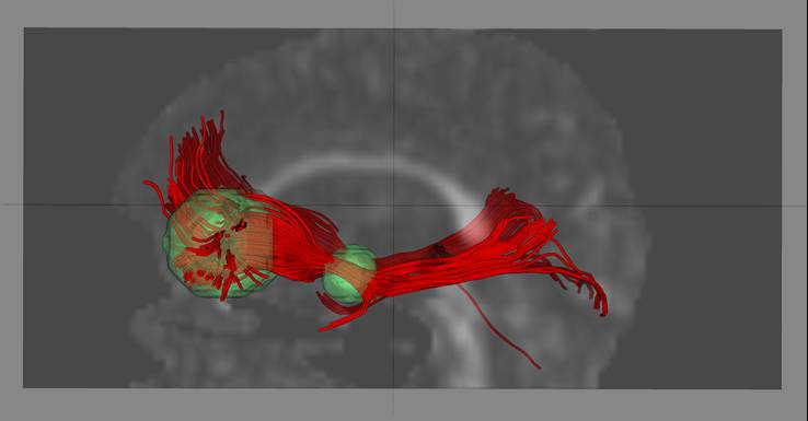 10_Amygdala_forebrain_side.jpg 10_Amygdala_forebrain_side.jpg