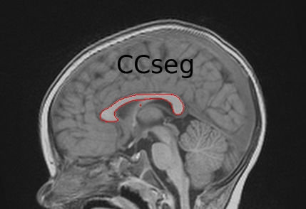 CCSeg logo