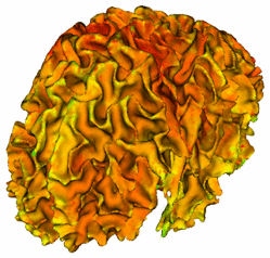 UNC Cortical Thickness logo