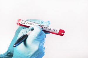 Negative Antibody Vial Image