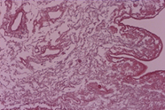 decellular liver HE1