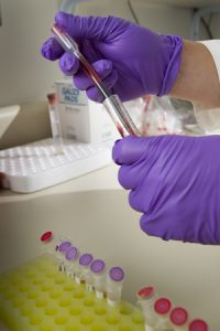 Researcher conducting biomarker research in lab.
