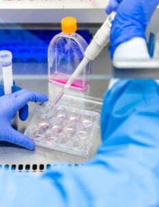 Researcher using pipette to change media in multi-cell plate.