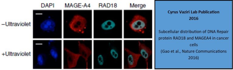 Subcellular distribution of DNA Repair protein RAD18 and MAGEA4 in cancer cells