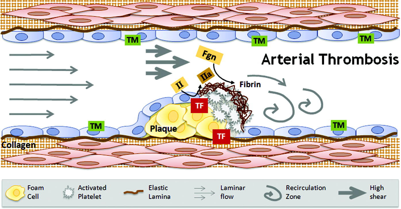 Interplay between abnormalities in blood components, the vasculature, and blood flow contribute to the development of arterial thrombosis. Arterial thrombosis involves the formation of platelet-rich “white clots” that form after rupture of atherosclerotic plaques and exposure of procoagulant material such as lipid-rich macrophages (foam cells), collagen, tissue factor, and/or endothelial breach, in a high shear environment. TM = thrombomodulin; II = prothrombin; IIa = thrombin; Fgn = fibrinogen; TF = tissue factor.